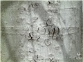 Maladie corticale du hêtre